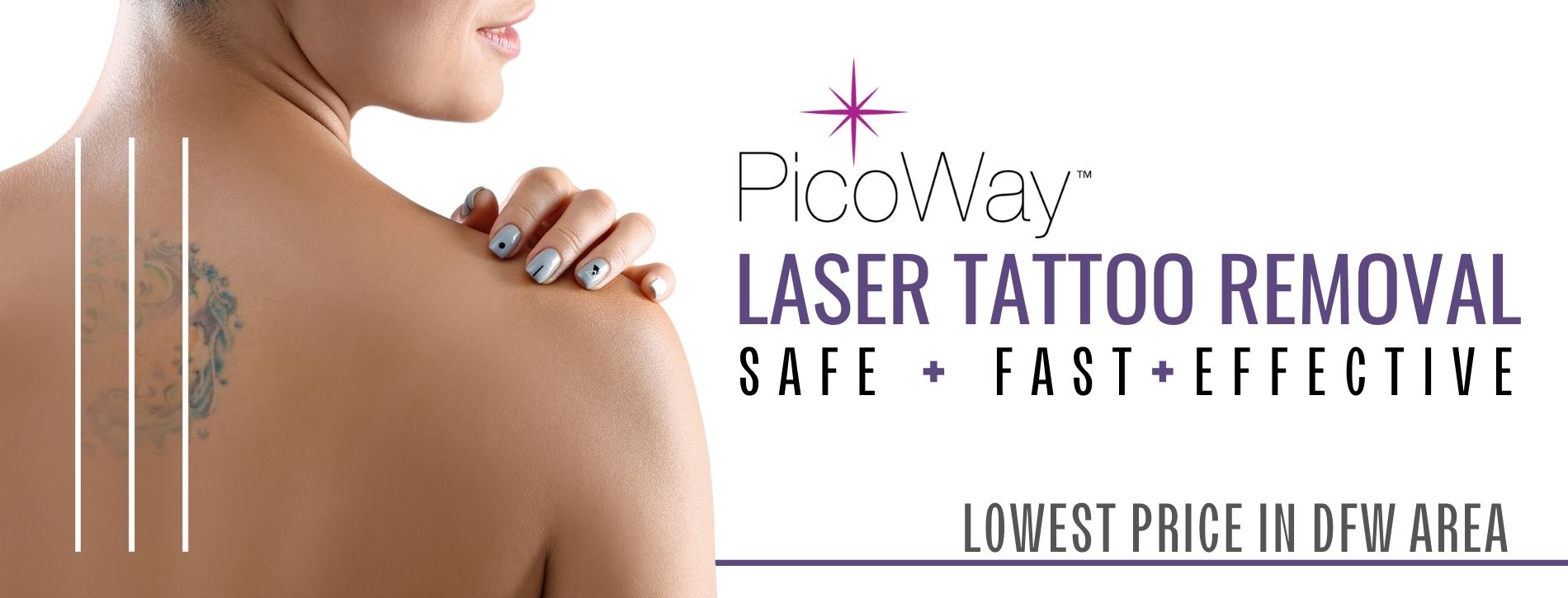Laser Tattoo Removal - DFW Tattoo Removal