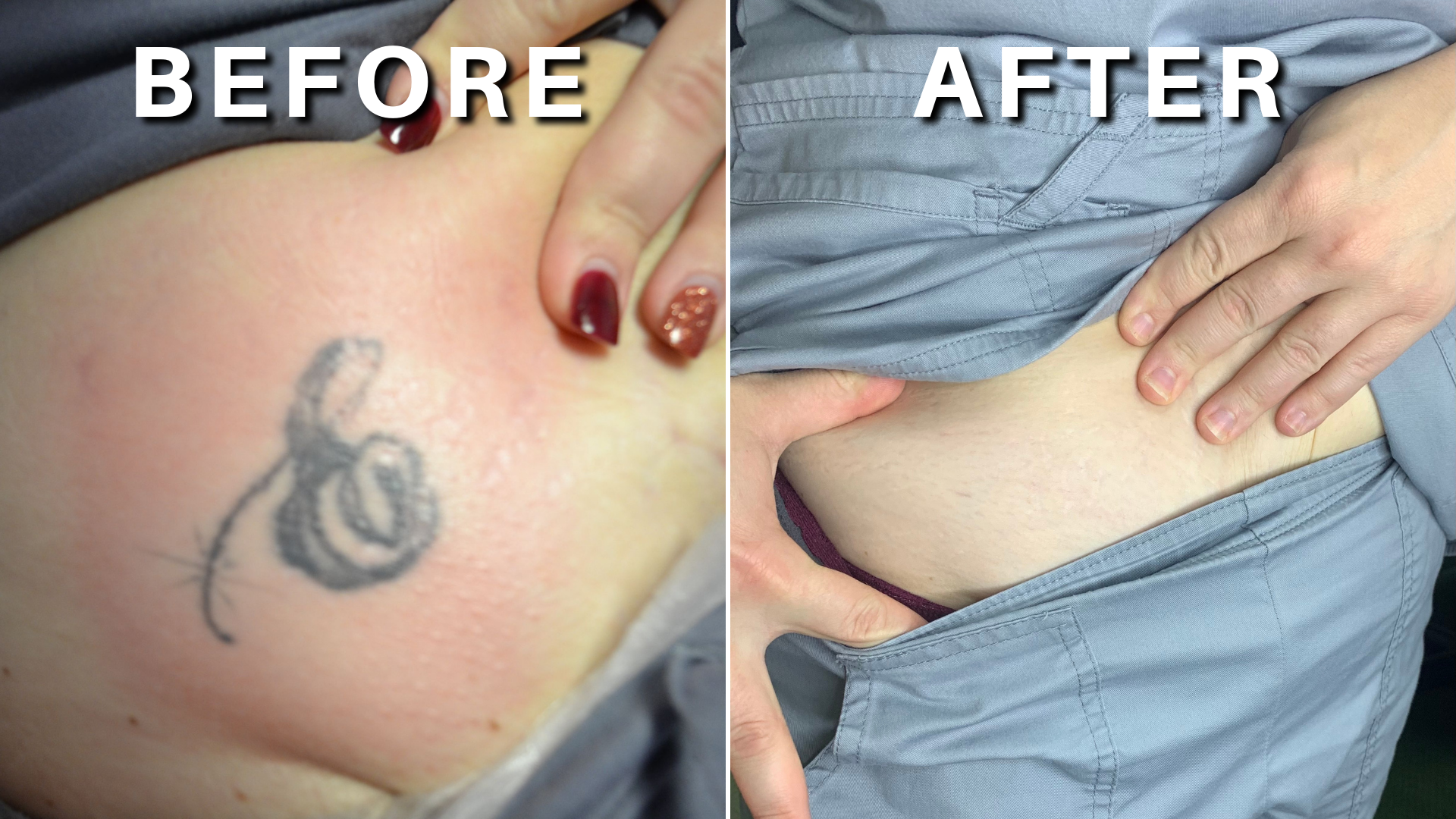 Before and after treatment